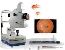 Digital fundus camera